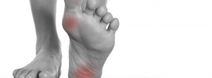 plantar fasciitis